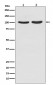 Anti-Androgen Receptor AR Rabbit Monoclonal Antibody
