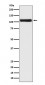 Anti-Androgen Receptor AR Rabbit Monoclonal Antibody
