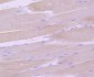 Anti-gamma Sarcoglycan Rabbit Monoclonal Antibody