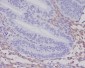 Anti-PDGF Receptor beta PDGFRB Rabbit Monoclonal Antibody