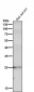 Anti-C Reactive Protein CRP Rabbit Monoclonal Antibody