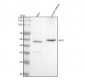 Anti-Vitamin D Receptor VDR Rabbit Monoclonal Antibody