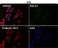 Anti-PI 3 Kinase p85 beta PIK3R2 Rabbit Monoclonal Antibody