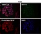 Anti-PI 3 Kinase p85 beta PIK3R2 Rabbit Monoclonal Antibody