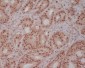 Anti-PI 3 Kinase p85 beta PIK3R2 Rabbit Monoclonal Antibody