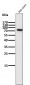 Anti-PI 3 Kinase p85 beta PIK3R2 Rabbit Monoclonal Antibody