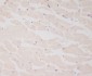 Anti-Myosin Light Chain 2 Rabbit Monoclonal Antibody