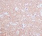 Anti-Tyrosine Hydroxylase TH Rabbit Monoclonal Antibody