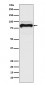 Anti-TGF beta Receptor II TGFBR2 Rabbit Monoclonal Antibody
