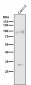 Anti-TGF beta Receptor II TGFBR2 Rabbit Monoclonal Antibody