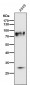 Anti-TGF beta Receptor II TGFBR2 Rabbit Monoclonal Antibody