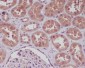 Anti-NF-Kappa B (p105/p50) NFKB1 Rabbit Monoclonal Antibody