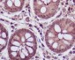 Anti-Lactate Dehydrogenase LDHA Rabbit Monoclonal Antibody