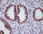 Anti-Progesterone Receptor PGR Rabbit Monoclonal Antibody