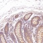 Anti-active + pro Caspase 3 CASP3 Rabbit Monoclonal Antibody