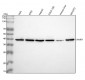 Anti-67kDa Laminin Receptor RPSA Rabbit Monoclonal Antibody