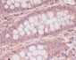 Anti-Myosin light chain kinase MYLK Rabbit Monoclonal Antibody