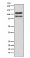 Anti-delta 1 Catenin/p120 Catenin Rabbit Monoclonal Antibody