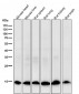 Anti-Retinoic Acid Receptor alpha RARA Rabbit Monoclonal Antibody