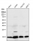 Anti-Retinoic Acid Receptor alpha RARA Rabbit Monoclonal Antibody