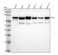 Anti-Stromal interaction molecule 1 STIM1 Rabbit Monoclonal Antibody