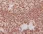 Anti-K63-linkage Specific Ubiquitin UBB Rabbit Monoclonal Antibody
