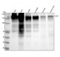 Anti-EGFR (ErbB 1) Monoclonal Antibody