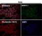 Anti-EGFR (ErbB 1) Monoclonal Antibody
