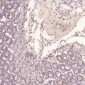 Anti-EGFR (ErbB 1) Monoclonal Antibody