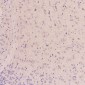 Anti-EGFR (ErbB 1) Monoclonal Antibody