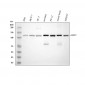 Anti-HIP1 Monoclonal Antibody