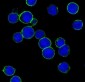 Anti-ErbB2 (HER2) Monoclonal Antibody