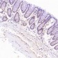 Anti-ErbB2 (HER2) Monoclonal Antibody