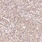 Anti-ErbB2 (HER2) Monoclonal Antibody