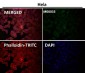 Anti-Notch1 Monoclonal Antibody