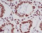 Anti-Histone H4 (acetyl K5) HIST1H4A Monoclonal Antibody