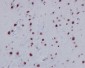 Anti-Histone H2A (acetyl K9) HIST1H2AB Monoclonal Antibody