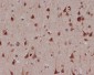 Anti-Phospho-MSK1 (S376) RPS6KA5 Monoclonal Antibody