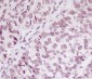 Anti-Phospho-SMC1 (S957) Monoclonal Antibody