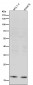 Anti-IL10 Monoclonal Antibody