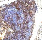 Anti-LMO2 Monoclonal Antibody