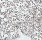 Anti-LMO2 Monoclonal Antibody