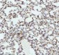Anti-LMO2 Monoclonal Antibody