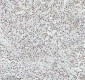 Anti-MTA2 Monoclonal Antibody