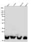 Anti-DHFR Monoclonal Antibody