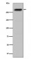 Anti-CENPE Monoclonal Antibody