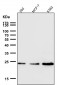 Anti-Ran Monoclonal Antibody