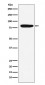 Anti-Factor XIIIa F13A1 Monoclonal Antibody