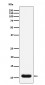 Anti-Trefoil Factor 3 Monoclonal Antibody