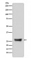Anti-NDUFS3 Monoclonal Antibody
